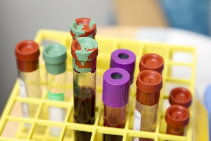 Blood tests for determining the diagnosis of back pain